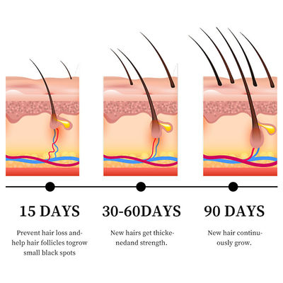 Potente siero anti-perdita di capelli con olio di zenzero e vitamina B5