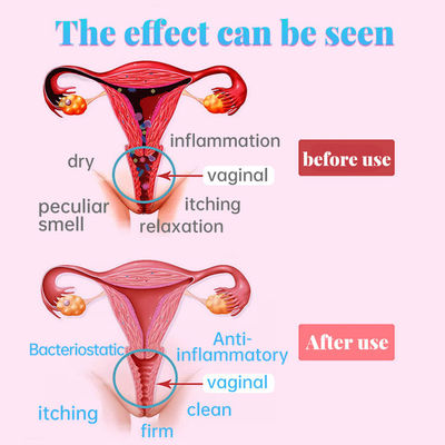 Prodotti per la cura della vagina per la salute delle donne Funzione di restringimento della vagina 2 anni di durata